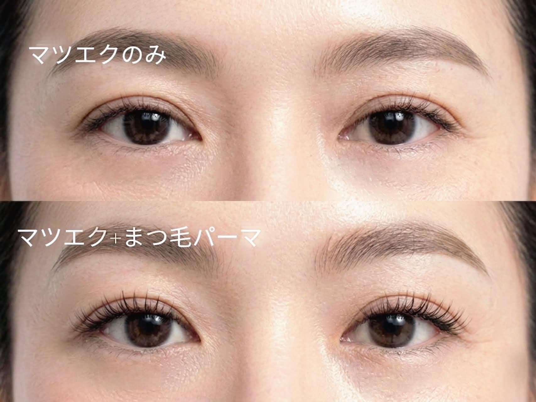 Millieye service visual for and healthy